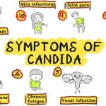 Candidiasis: The Dangers of Yeast Overgrowth