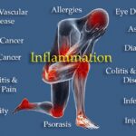 Important Tips to Battle Inflammation Before It Destroys You